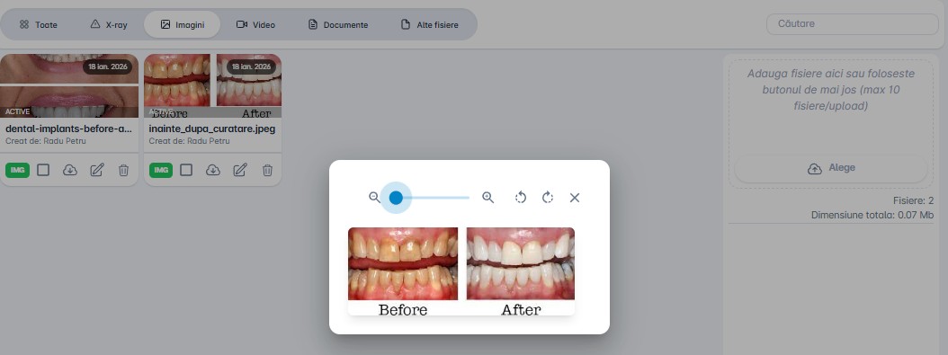 Modul media before and after