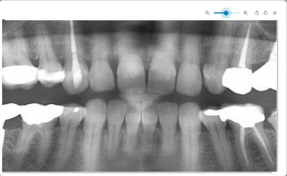 Vizualizare radiografie direct din fisa pacient