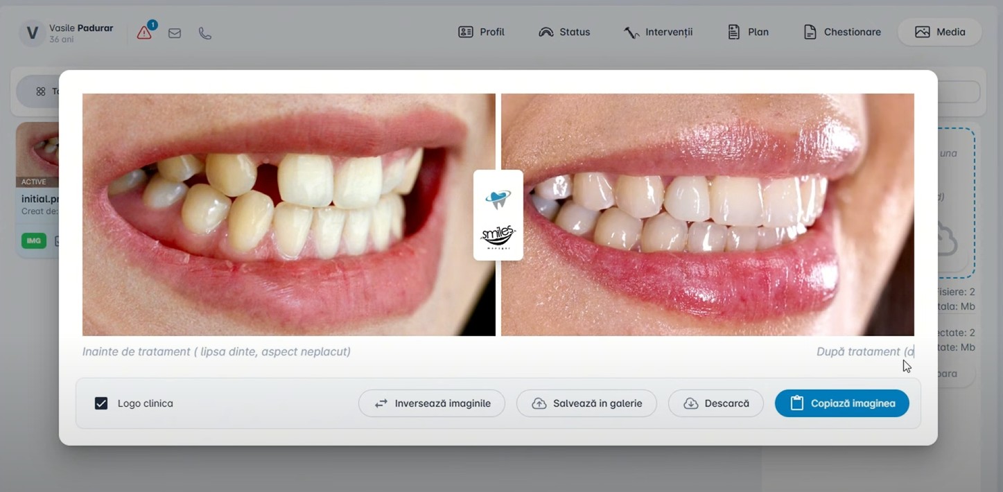 Before and after tratament stomatologic